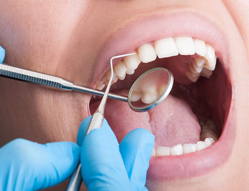 Patient getting professional dental cleaning