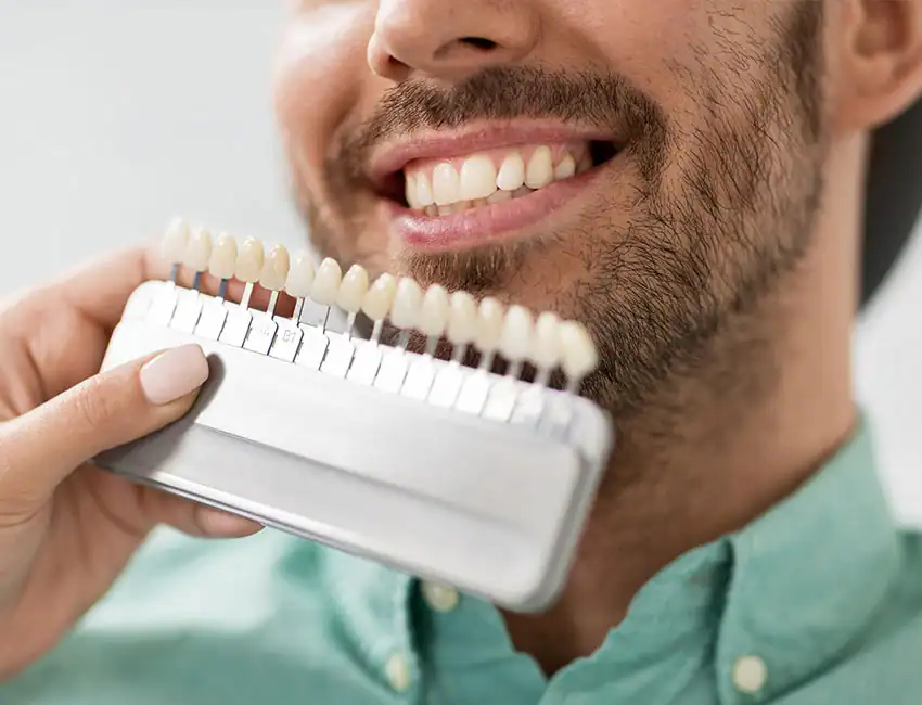 Teeth Whitening at Canyon Country Dental Care