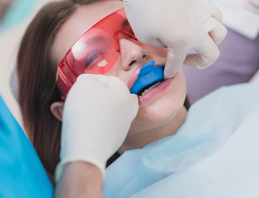 Fluoride Treatments at Canyon Country Dental Care