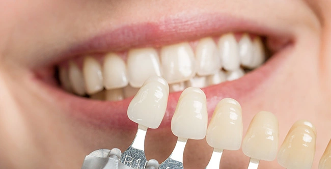 Dental Bonding, Shaping, Contouring at Canyon Country Dental Care