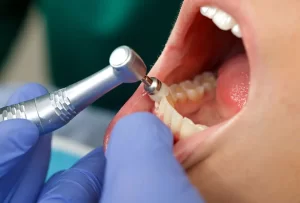 Patient getting dental cleaning in Canyon Country, CA