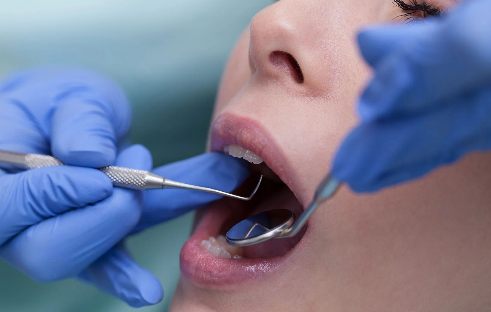 Dentist checking patients teeth in Canyon Country, CA