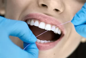 Teeth cleaning in Canyon Country, CA